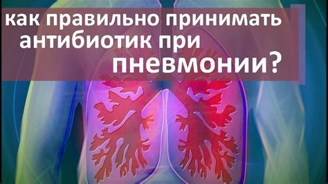 Диагностика и лечение вирусной пневмонии: эффективные методы борьбы