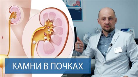 Диагностика и лечение новообразований в почках