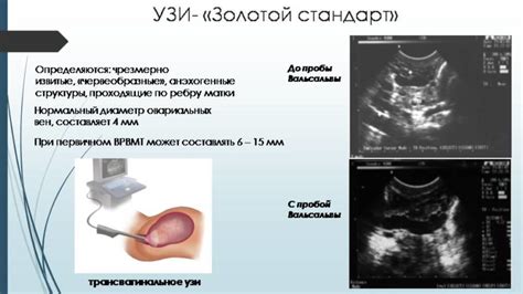 Диагностика и лечение различных патологий органов таза