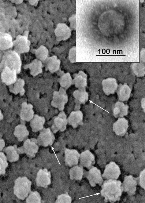 Диагностика и лечение SARS и MERS