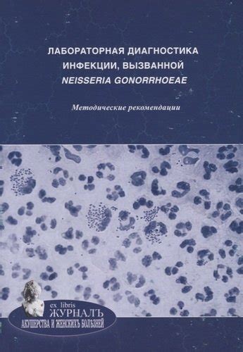 Диагностика и терапия инфекции вызванной энтеробактериями у младенца