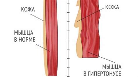 Диагностика особенностей непроизвольных сокращений мышц у взрослых