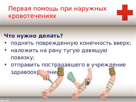 Диагностика повреждения и необходимость надевания специальной фиксации на поврежденную конечность