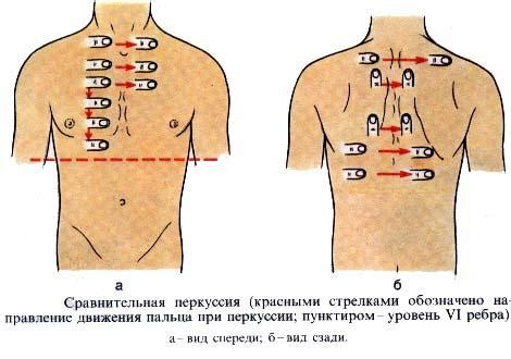 Диагностические методы для выявления соответствия границ верхних частей легких
