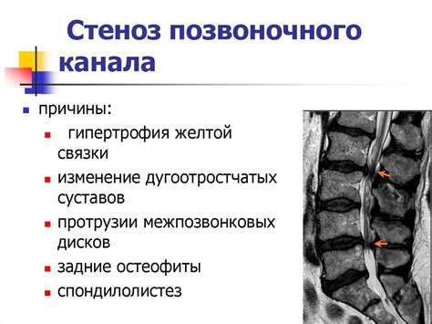 Диагностические методы для определения позиции сегментов C5 C6 позвоночного отдела