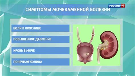 Диагностические методы при бледной моче у мужчин