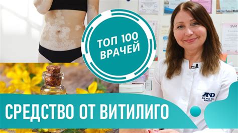 Диета и витаминотерапия при витилиго