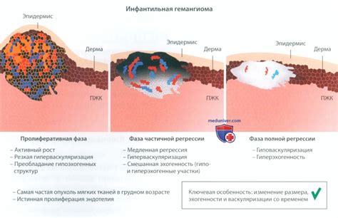 Дооперационные особенности гемангиомы