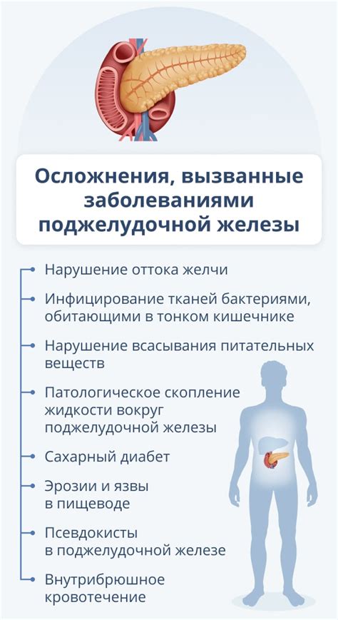 Доступные методы лечения видоизмененной поджелудочной железы