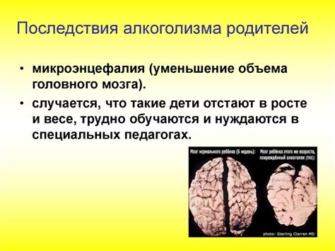 Заболевания, передаваемые путем потребления молока