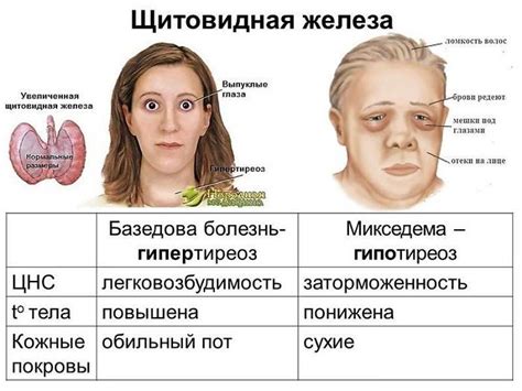 Заболевания, связанные с длительным воздействием тиурамов