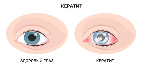 Заболевания глаз, которые могут вызвать появление белого цвета в глазах наших домашних питомцев