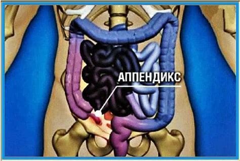 Заболевания кожи в окрестности анального отверстия: основные причины и методы лечения