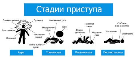 Запись времени и продолжительности эпилептического приступа