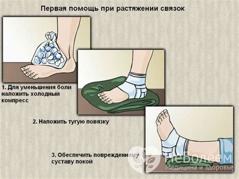 Застывший помощник при растяжении связок