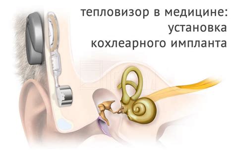 Значение определения местонахождения речевого центра при хирургическом вмешательстве в мозг