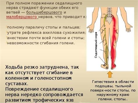 Значение седалищного нерва и его влияние на организм