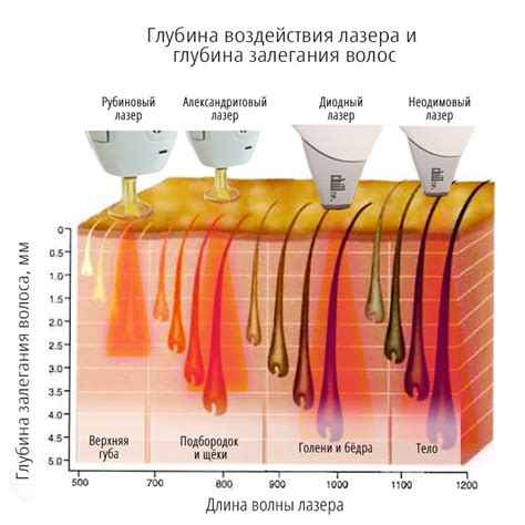 Значение сохранения длины волос при проведении процедуры лазерной эпиляции