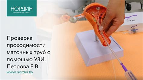 Значимость обнаружения перевязки труб на УЗИ для дальнейшего лечения