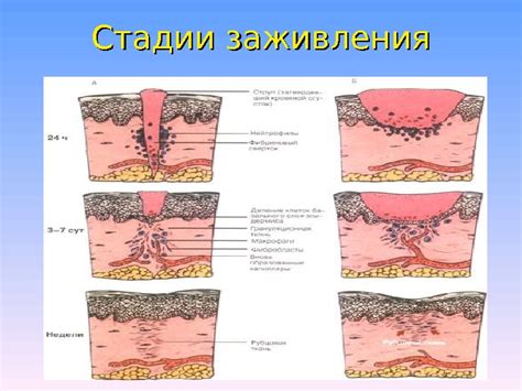 Излечение раны: детальное описание процесса и ключевые моменты