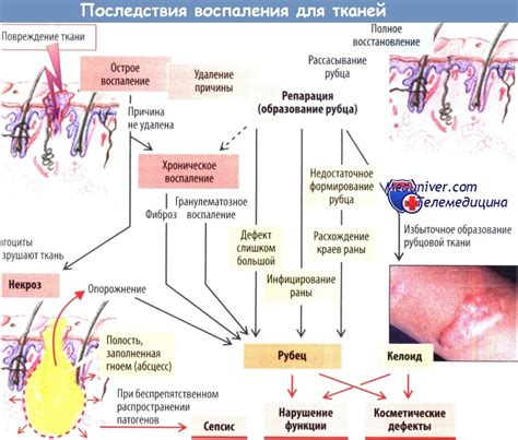 Изменение телесной температуры как индикатор развития воспаления