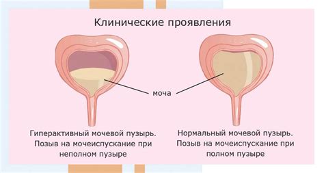 Изменения функциональности мочевого пузыря при дефиците эстрогенов