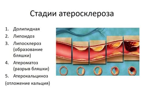 Использование нитратов в лечении заболеваний сердечно-сосудистой системы