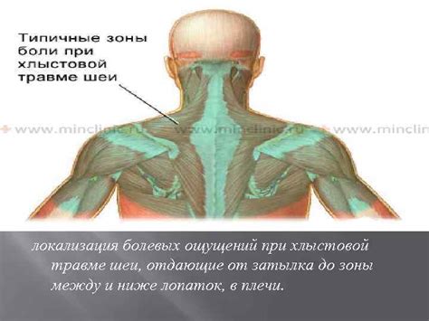 Источники болевых ощущений и неудобств при проблемах с позвоночным диском