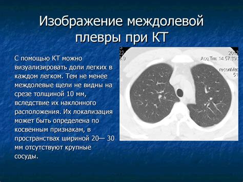 КТ плевра и бронхов: принцип работы и назначение исследования