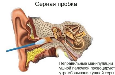 Как быстро заживают отверстия в ушах: советы для ухода и предотвращения осложнений