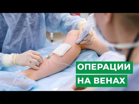 Как выбрать место для операции на венах: критерии выбора