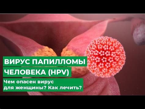 Как диагностировать вирус папилломы 16 типа