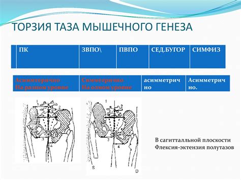 Как отличить поясничные неприятности от дисфункции области Сакро-Илиакальных суставов (СИ-суставы)