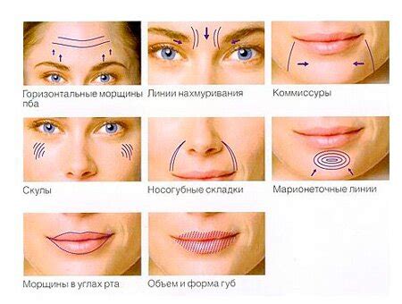 Как правильно подобрать процедуры косметологии для устранения выпуклостей щек