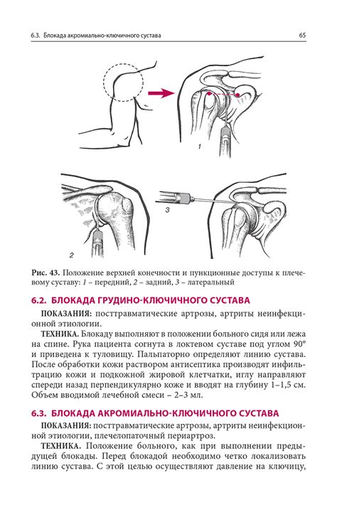 Как проходит новокаиновая блокада