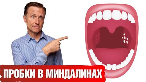 Как эффективно справиться с проблемой гноя в миндалинах: проверенные методы