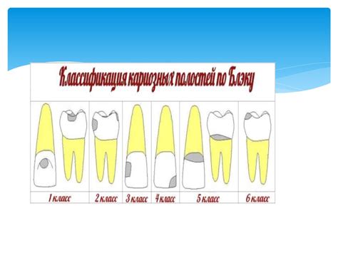 Классические принципы препарирования семян моющей травы