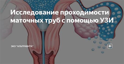 Когда целесообразно проводить исследование устьев маточных труб с помощью гистероскопии