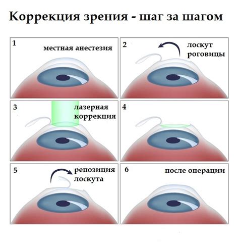 Коррекция зрения у специалиста: методики и преимущества