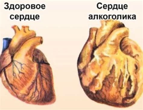 Красная лента: взаимосвязь употребления алкоголя и сердечно-сосудистых заболеваний