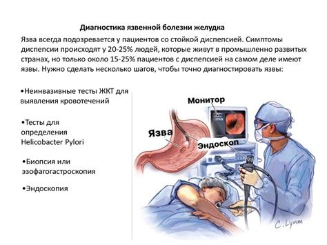 Лечение вируса язвы желудка