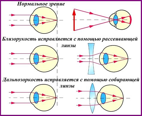 Линзы и оптическая система