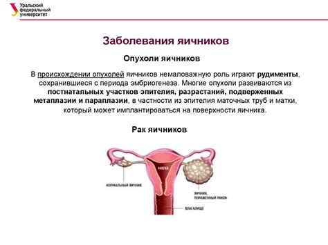Локализация ключевых лимфоузлов в системе органов женского репродуктивного тракта