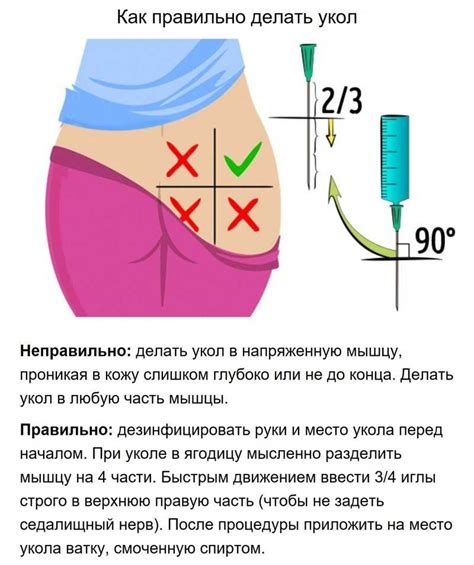 Медикаментозная терапия после онемения от инъекции в ягодицу