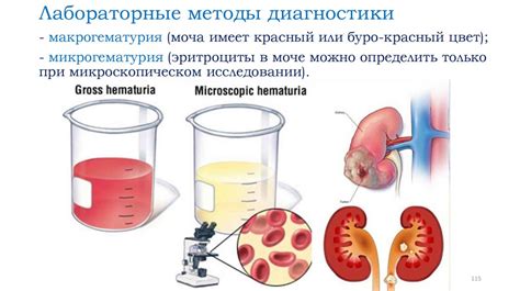 Медикаментозные препараты в терапии нарушений мочевыделительной системы у детей