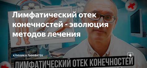 Меры, которые помогут предотвратить отек конечностей во время лечения антибиотиками