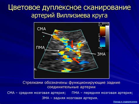 Методы диагностики Виллизиева круга