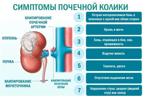 Методы облегчения боли при колике почек