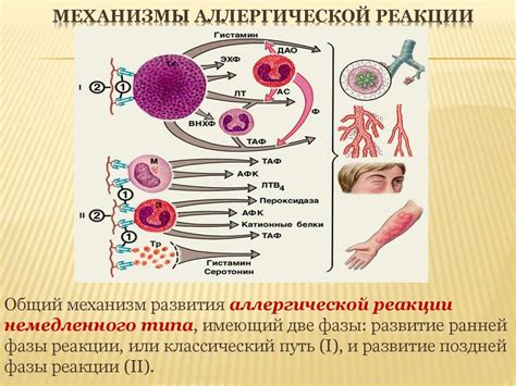 Механизмы возникновения чувства зуда при аллергической реакции