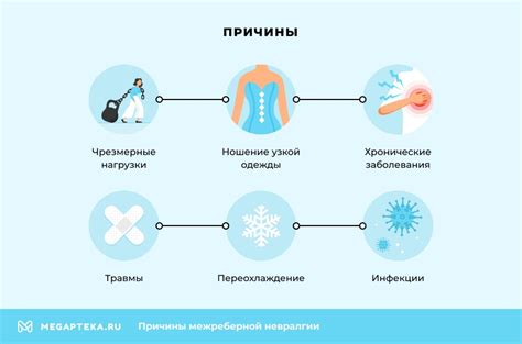 Механизмы развития головокружения при межреберной невралгии